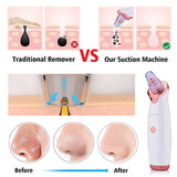 Blackhead Electric Suction