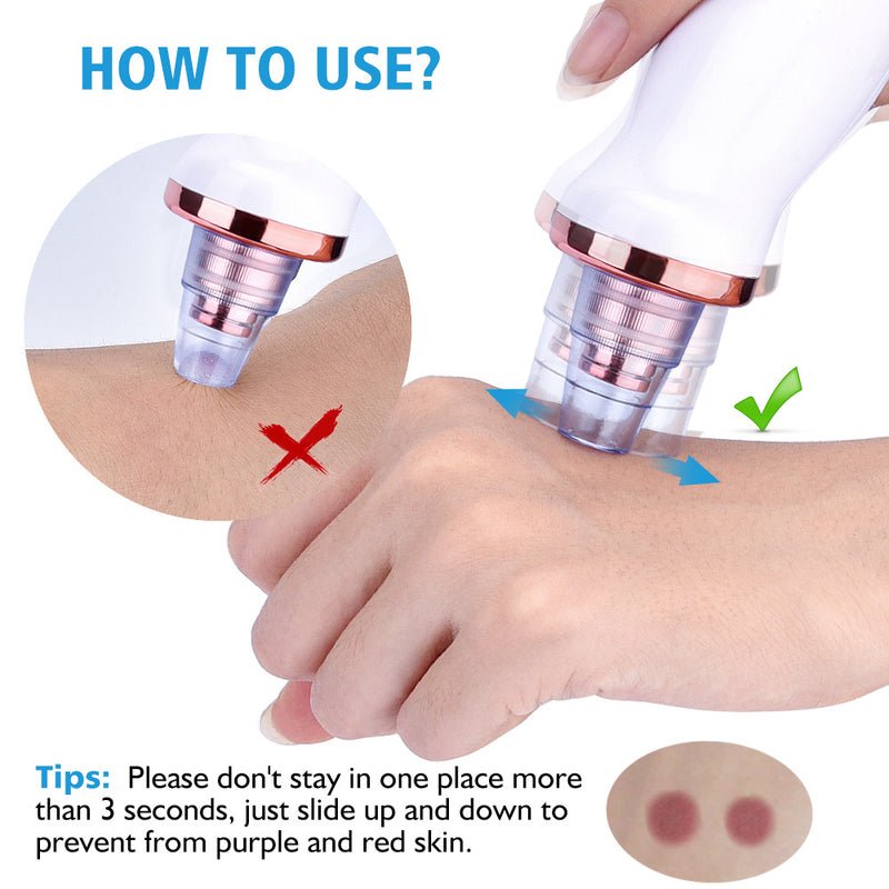 Blackhead Electric Suction